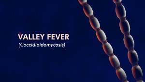 Valley fever graphic